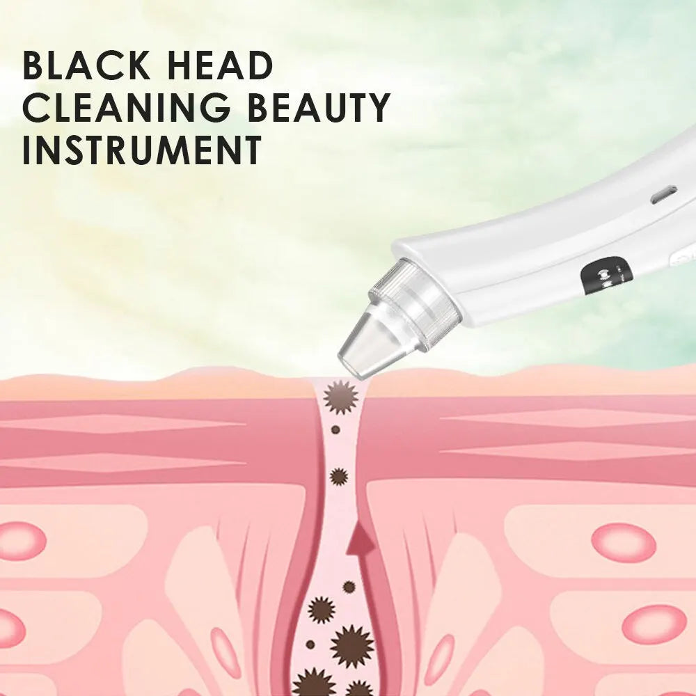 The Pore Refining Vacuum